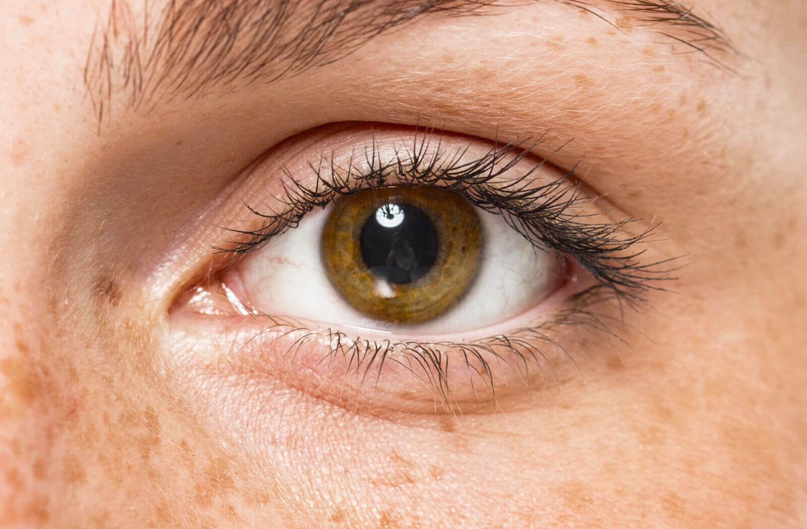 What Causes Dry Eyes with Contacts? Stoney Creek Eye Care